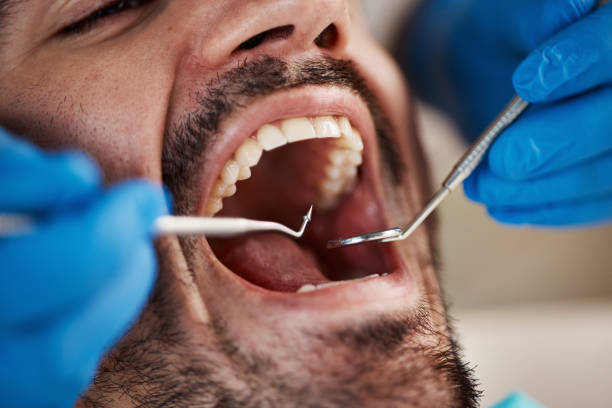 Best Emergency Dental Care  in Carthage, MS